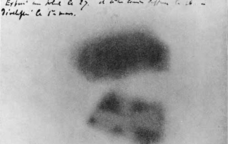 Fotografická deska zobrazující účinky vystavení radioaktivitě (obrázek: Henri Becquerel, Public domain, via Wikimedia Commons)
