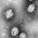 Obr. 1: Několik virů SARS-CoV-2 v buňce. Obraz z elektronového mikroskopu, měřítko 100 nm (zdroj: https://www.who.int/csr/sars/coronavirus/en/)